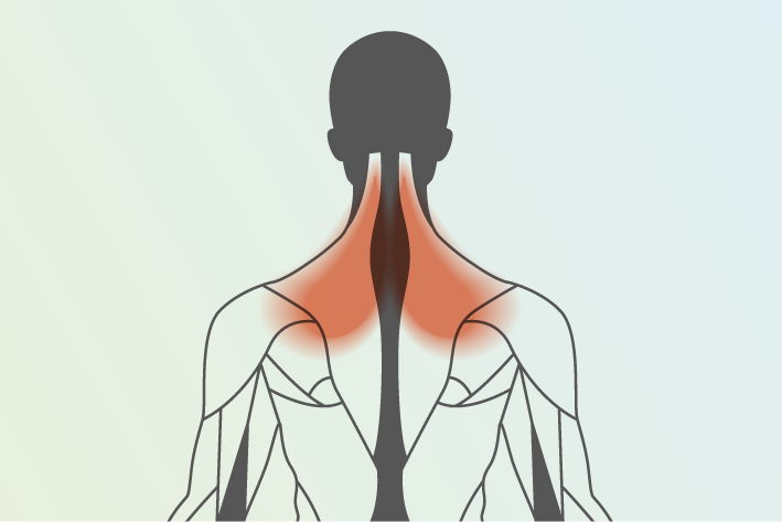 diagram of human body showing neck and shoulder pain