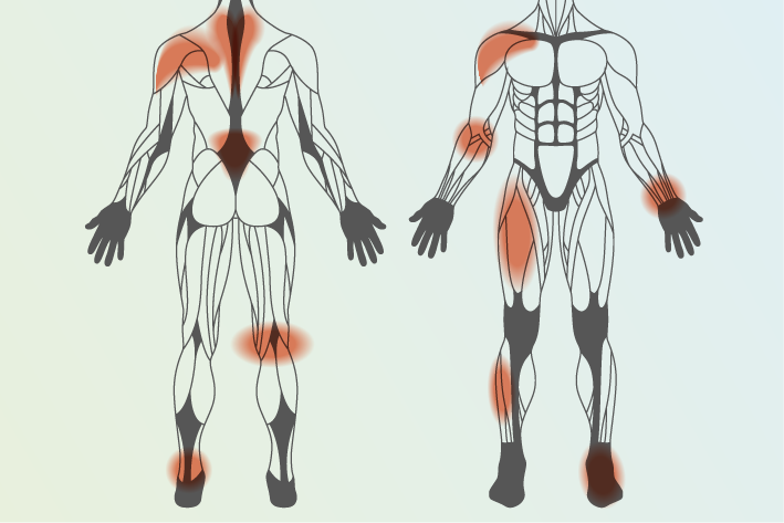diagram of human body showing areas of pain caused associated with sport